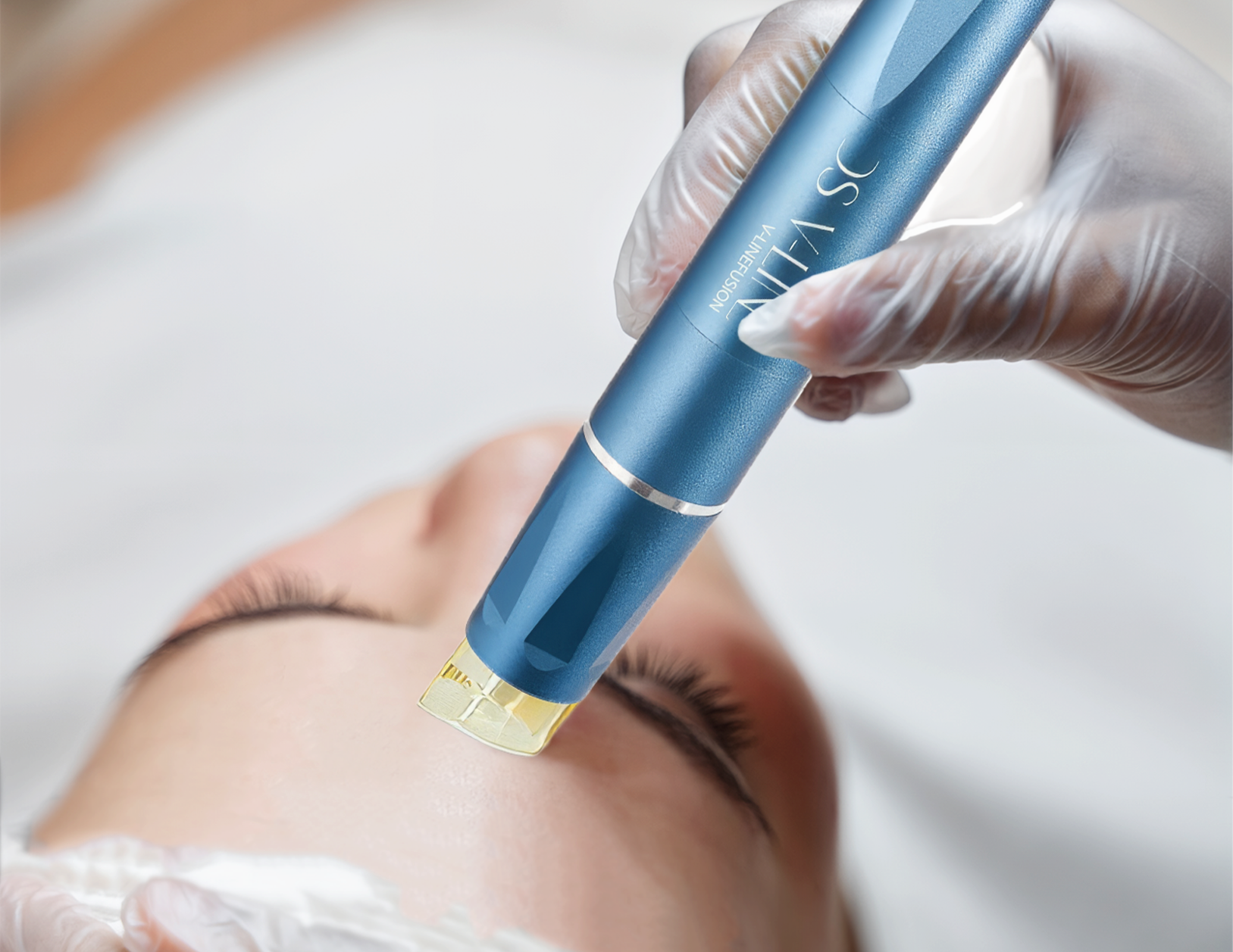 Why is "Microneedling" So Popular for Facial Rejuvenation?